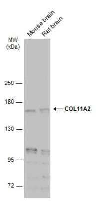 Western Blot: Collagen XI alpha 2 Antibody (212) [NBP2-43747]