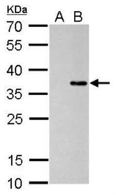 Western Blot: Collagen XI alpha 2 Antibody (473) [NBP2-43728]