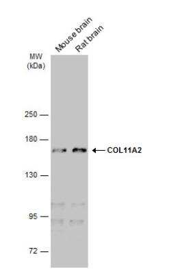 Western Blot: Collagen XI alpha 2 Antibody (473) [NBP2-43728]