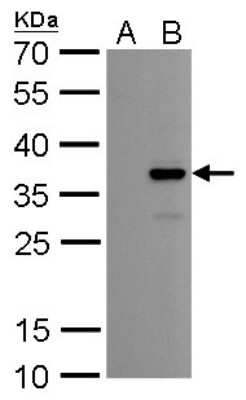 Western Blot: Collagen XI alpha 2 Antibody (6410) [NBP2-43809]