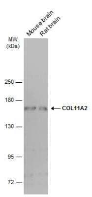 Western Blot: Collagen XI alpha 2 Antibody (6410) [NBP2-43809]