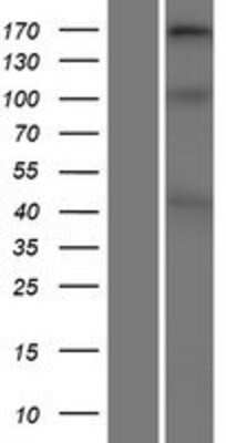 Western Blot: Collagen XI alpha 2 Overexpression Lysate [NBP2-05767]