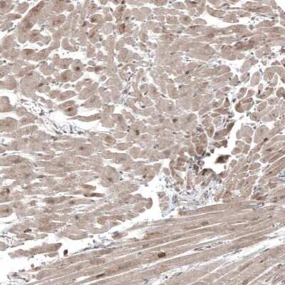 Immunohistochemistry-Paraffin: Collagen XII alpha1 Antibody [NBP1-88062]