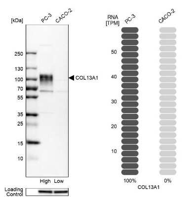 Western Blot: Collagen XIII alpha 1 Antibody [NBP2-13854]