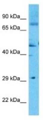 Western Blot: Collagen XIII alpha 1 Antibody [NBP3-10780]