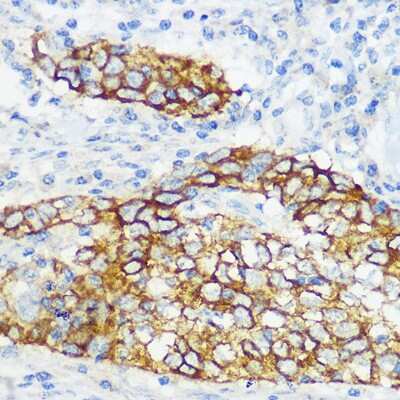 Immunohistochemistry-Paraffin: Collagen XVII Antibody (8W2C8) [NBP3-16485]
