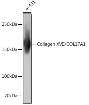 Western Blot: Collagen XVII Antibody (8W2C8) [NBP3-16485]