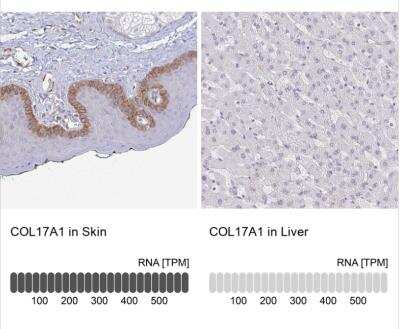 Immunohistochemistry-Paraffin: Collagen XVII Antibody [NBP1-91800]