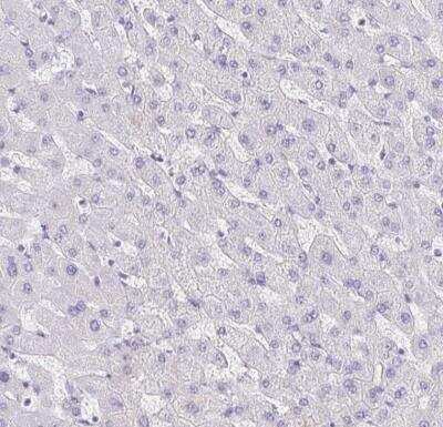 Immunohistochemistry-Paraffin: Collagen XVII Antibody [NBP1-91800]