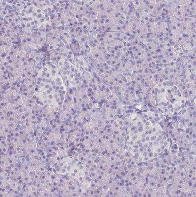 Immunohistochemistry-Paraffin: Collagen XVII Antibody [NBP1-91800]