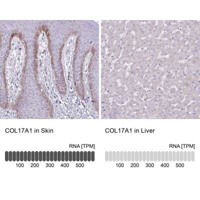 Immunohistochemistry-Paraffin: Collagen XVII Antibody [NBP2-38686]