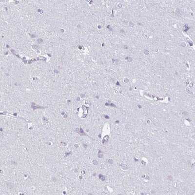 Immunohistochemistry-Paraffin: Collagen XVII Antibody [NBP2-38686]