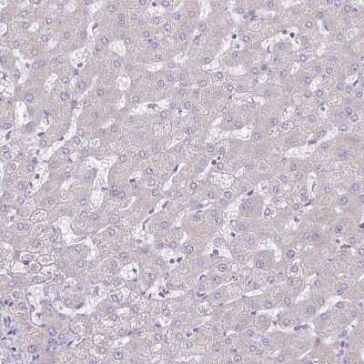 Immunohistochemistry-Paraffin: Collagen XVII Antibody [NBP2-38686]