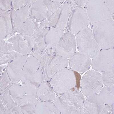 Immunohistochemistry-Paraffin: Collagen XVII Antibody [NBP2-38686]