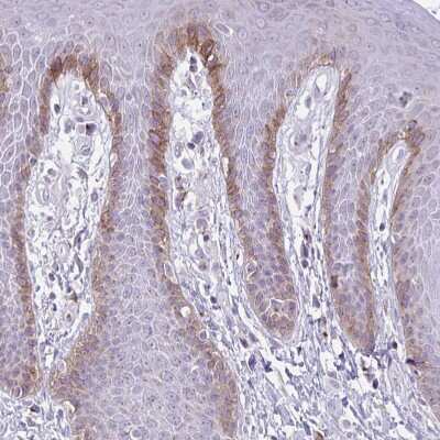 Immunohistochemistry-Paraffin: Collagen XVII Antibody [NBP2-38686]