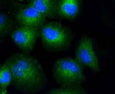 Immunocytochemistry/ Immunofluorescence: Collagen XVII Antibody (SR46-05) [NBP2-67316]