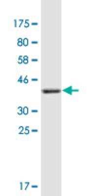 Western Blot: Collagen XXI Antibody (1G6) [H00081578-M01]