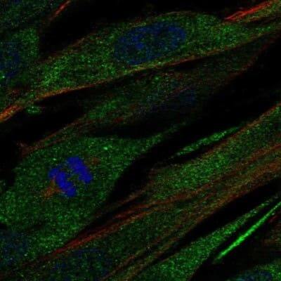 Immunocytochemistry/ Immunofluorescence: Collagen XXI Antibody [NBP1-91015]