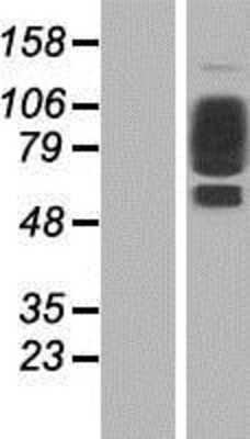 Western Blot: Collagen XXI Overexpression Lysate [NBP2-06174]