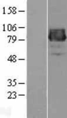 Western Blot: Collagen XXV alpha 1 Overexpression Lysate [NBL1-09352]