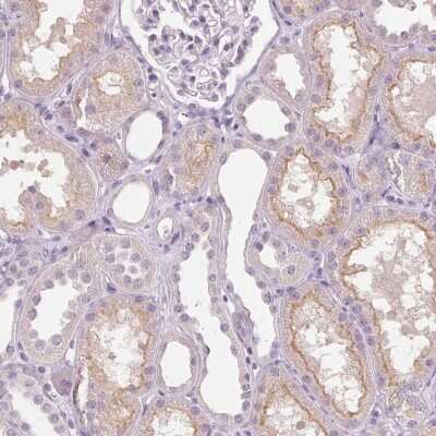 Immunohistochemistry-Paraffin: Collectrin/TMEM27 Antibody [NBP2-13450]