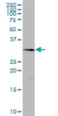 Western Blot: Collectrin/TMEM27 Antibody [H00057393-B01P]