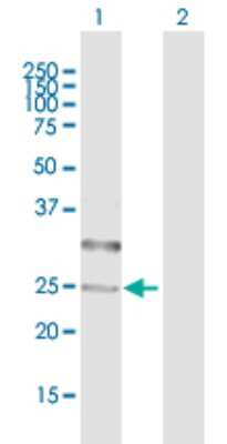 Western Blot: Collectrin/TMEM27 Antibody [H00057393-B01P]