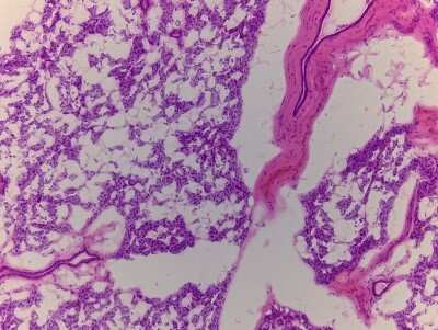 Hematoxylin & Eosin Stain: Colon Tissue Slides (Adult Normal)- Frozen [NBP2-77567]