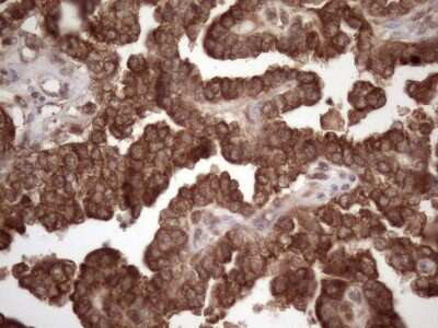 Immunohistochemistry: Common beta Chain Antibody (OTI4H3) [NBP2-46365]