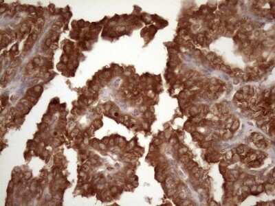 Immunohistochemistry: Common beta Chain Antibody (OTI4H3) [NBP2-46365]