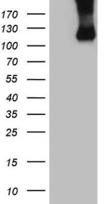 Western Blot: Common beta Chain Antibody (OTI4H3) [NBP2-46365]