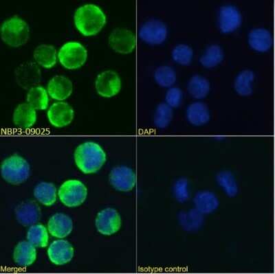 Immunocytochemistry/ Immunofluorescence: Common beta Chain Antibody (BION-1) - Chimeric - Azide and BSA Free [NBP3-09025]