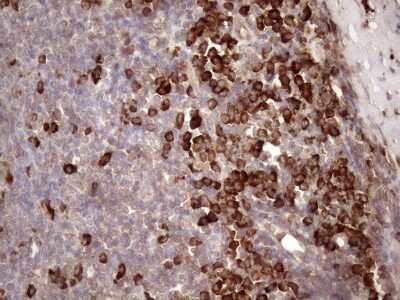 Immunohistochemistry: Common beta Chain Antibody (OTI4H3) - Azide and BSA Free [NBP2-70463]