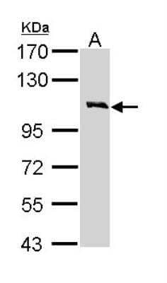 Western Blot: Common beta Chain Antibody [NBP1-31771]