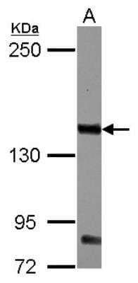 Western Blot: Common beta Chain Antibody [NBP2-16954]