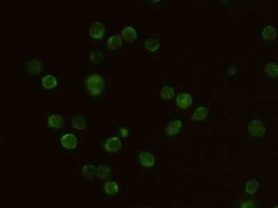 Immunocytochemistry/ Immunofluorescence: Common gamma Chain/IL-2 R gamma Antibody (011) [NBP2-90408]