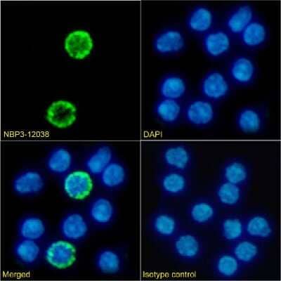 Immunocytochemistry/ Immunofluorescence: Common gamma Chain/IL-2 R gamma Antibody (3E12) - Chimeric - Azide and BSA Free [NBP3-12038]