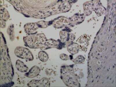 Immunohistochemistry-Paraffin: Common gamma Chain/IL-2 R gamma Antibody (MM0195-7A23) - Azide and BSA Free [NBP2-12201]