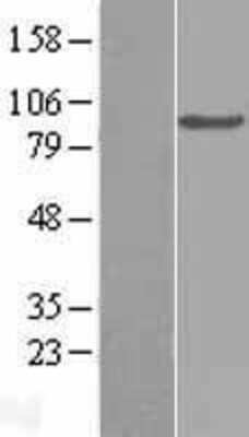 Western Blot: Complement Component C2 Overexpression Lysate [NBL1-08352]