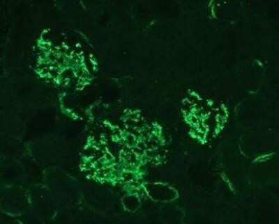 Immunocytochemistry/ Immunofluorescence: Complement C3 Antibody (11H9) - Azide and BSA Free [NBP2-80677]