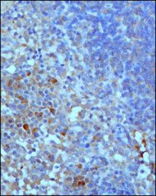 Immunohistochemistry-Paraffin: Complement C3 Antibody (11H9) - BSA Free [NB200-540]