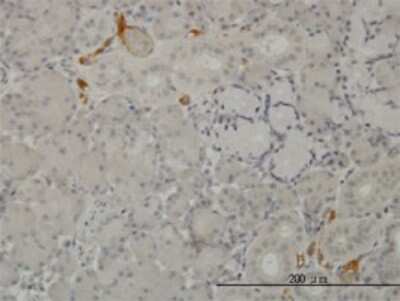 Immunohistochemistry-Paraffin: Complement C3 Antibody (5F9) [H00000718-M01]