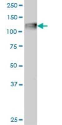 Western Blot: Complement C3 Antibody (5F9) [H00000718-M01]