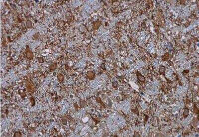 Immunohistochemistry-Paraffin: Complement C3 Antibody [NBP1-32080]