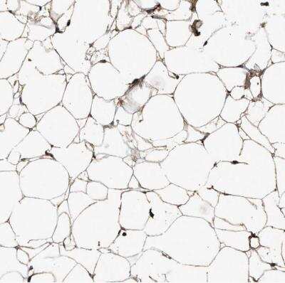 Immunohistochemistry-Paraffin: Complement C3 Antibody [NBP1-85492]