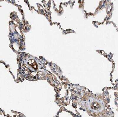 Immunohistochemistry-Paraffin: Complement C3 Antibody [NBP1-85492]