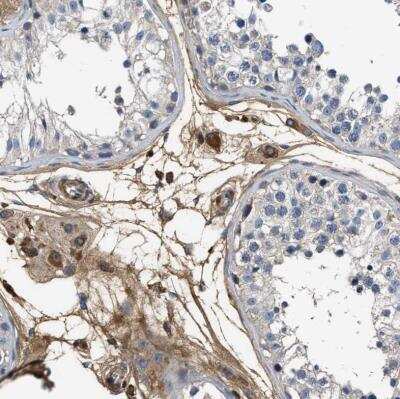 Immunohistochemistry-Paraffin: Complement C3 Antibody [NBP1-85492]