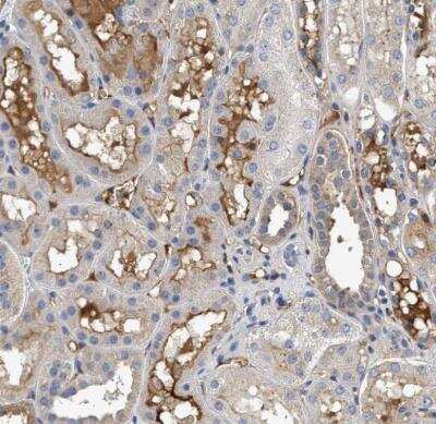 Immunohistochemistry-Paraffin: Complement C3 Antibody [NBP1-85492]
