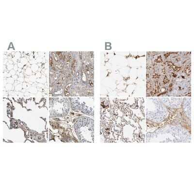 Immunohistochemistry-Paraffin: Complement C3 Antibody [NBP1-85492]