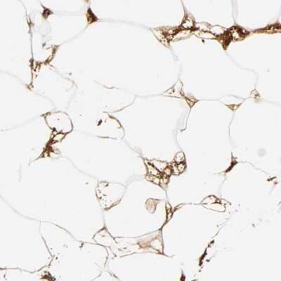 Immunohistochemistry-Paraffin: Complement C3 Antibody [NBP1-85493]